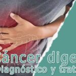 Cáncer digestivo: Todo lo que necesitas saber sobre su diagnóstico y tratamiento