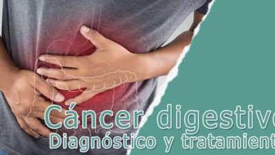 Cáncer digestivo: Todo lo que necesitas saber sobre su diagnóstico y tratamiento 9 Cáncer digestivo - diagnóstico y tratamiento