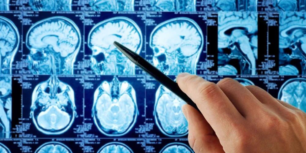 Centro de Neurología Avanzado: Innovación y atención especializada 6 Trastornos neuroinmunológicos y sus abordajes clínicos